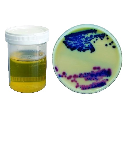 microbiological solution1_500x580